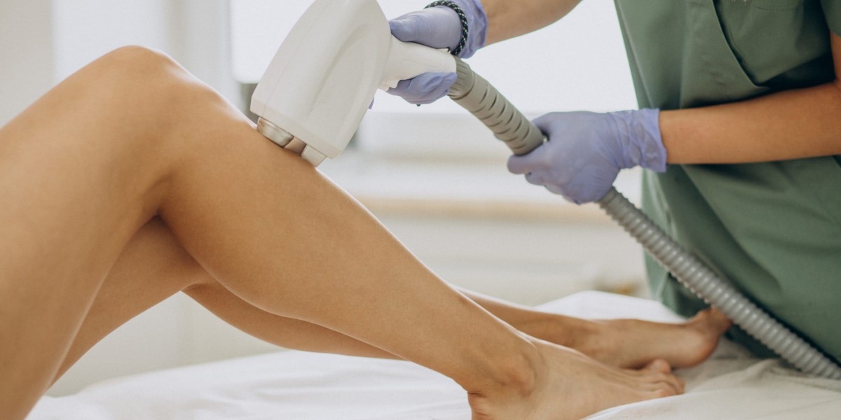 Laser Hair Removal and PCOS: A Game-Changer for Hormonal Hair Growth