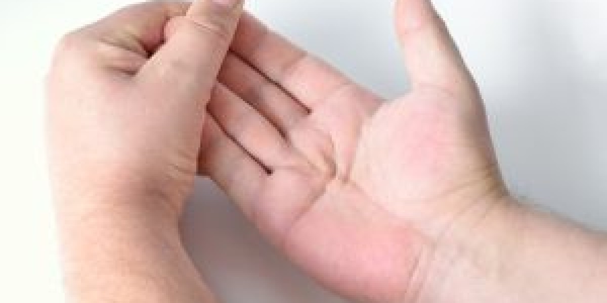Natural Remedies for Dupuytren's Contracture to Help Reduce Hand Tightness