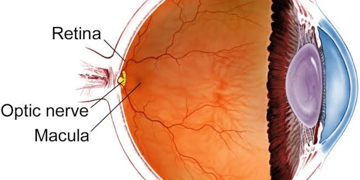 Best Retina Specialist in Delhi for Retinal Eye Conditions