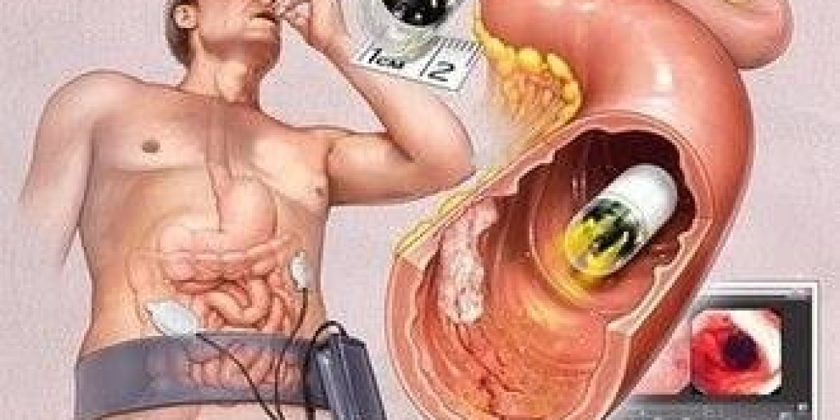 Painless Colonoscopy Hospital in Guwahati: Colonoscopy Care